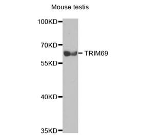 Western blot - TRIM69 antibody from Signalway Antibody (38716) - Antibodies.com