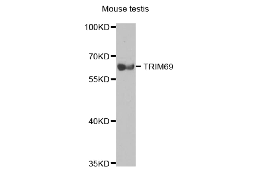 Western blot - TRIM69 antibody from Signalway Antibody (38716) - Antibodies.com