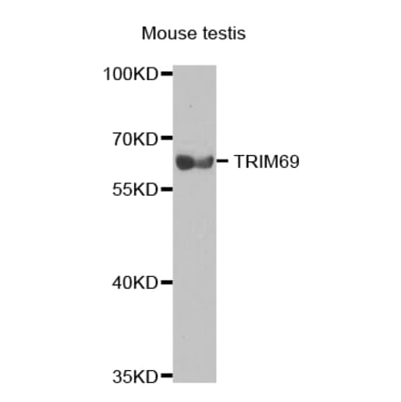 Western blot - TRIM69 antibody from Signalway Antibody (38716) - Antibodies.com