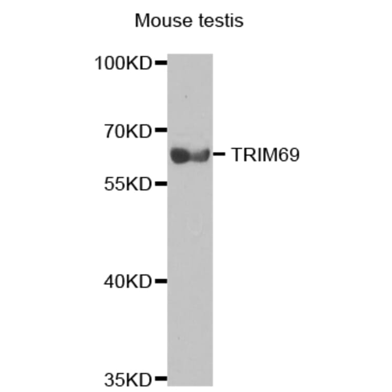 Western blot - TRIM69 antibody from Signalway Antibody (38716) - Antibodies.com