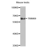 Western blot - TRIM69 antibody from Signalway Antibody (38716) - Antibodies.com