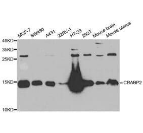 Western blot - CRABP2 antibody from Signalway Antibody (38717) - Antibodies.com