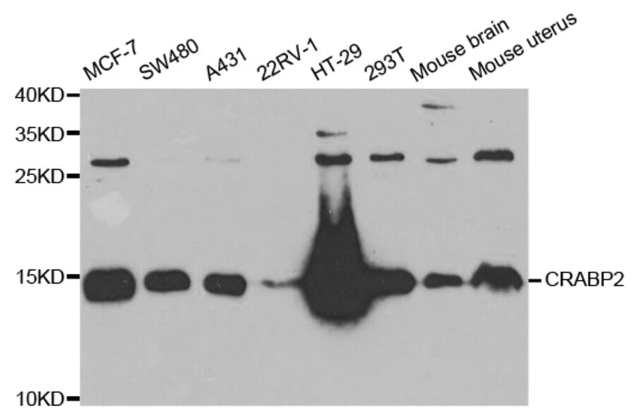 Western blot - CRABP2 antibody from Signalway Antibody (38717) - Antibodies.com