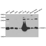 Western blot - CRABP2 antibody from Signalway Antibody (38717) - Antibodies.com