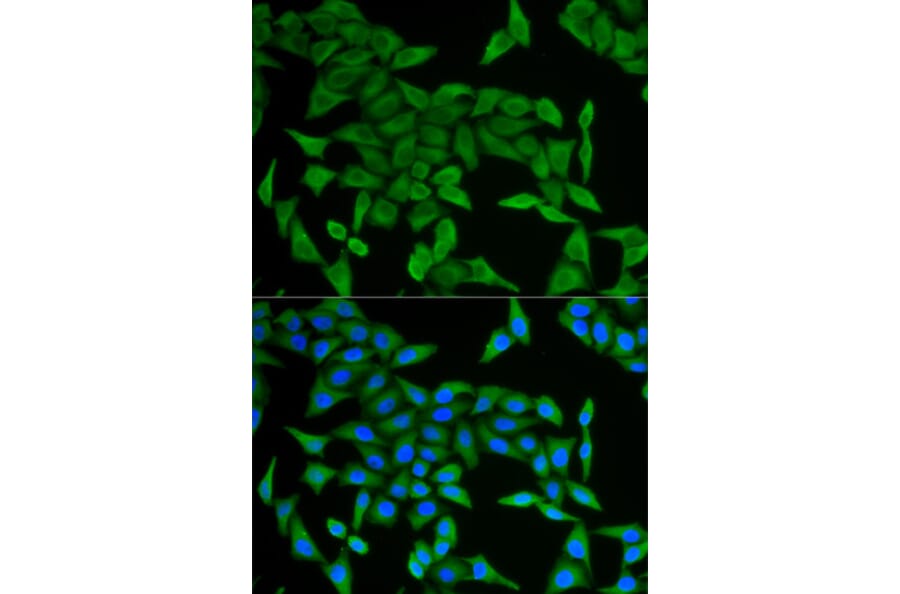 Immunofluorescence - CRABP2 antibody from Signalway Antibody (38717) - Antibodies.com
