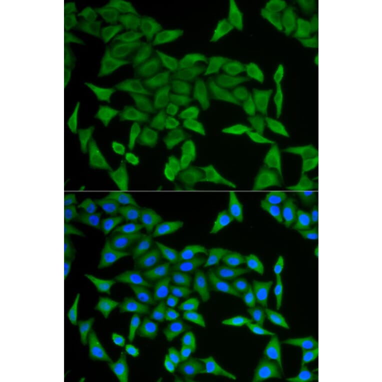 Immunofluorescence - CRABP2 antibody from Signalway Antibody (38717) - Antibodies.com