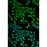 Immunofluorescence - CRABP2 antibody from Signalway Antibody (38717) - Antibodies.com