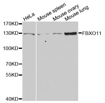 Western blot analysis of extracts of various cell lines, using FBXO11 antibody.