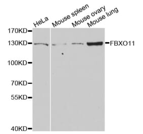 Western blot - FBXO11 antibody from Signalway Antibody (38737) - Antibodies.com
