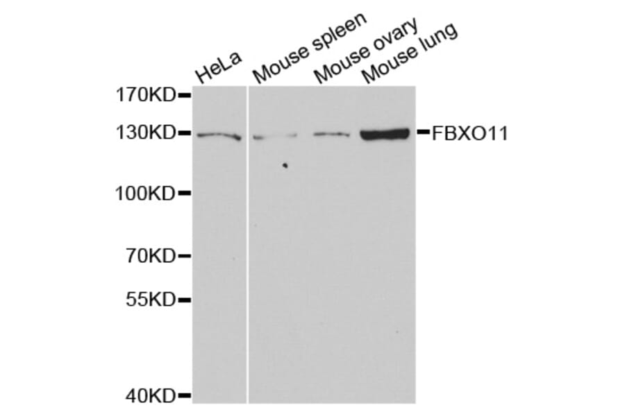 Western blot - FBXO11 antibody from Signalway Antibody (38737) - Antibodies.com