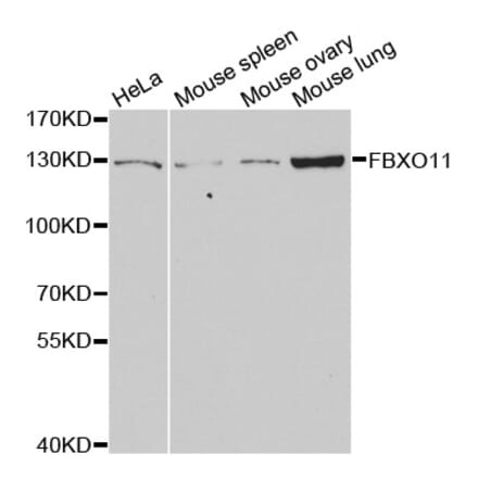 Western blot - FBXO11 antibody from Signalway Antibody (38737) - Antibodies.com