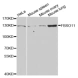 Western blot - FBXO11 antibody from Signalway Antibody (38737) - Antibodies.com