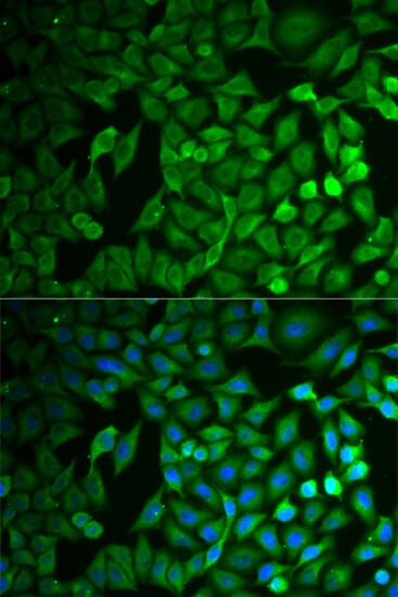 Immunofluorescence analysis of MCF-7 cell using FBXO11 antibody. Blue: DAPI for nuclear staining.