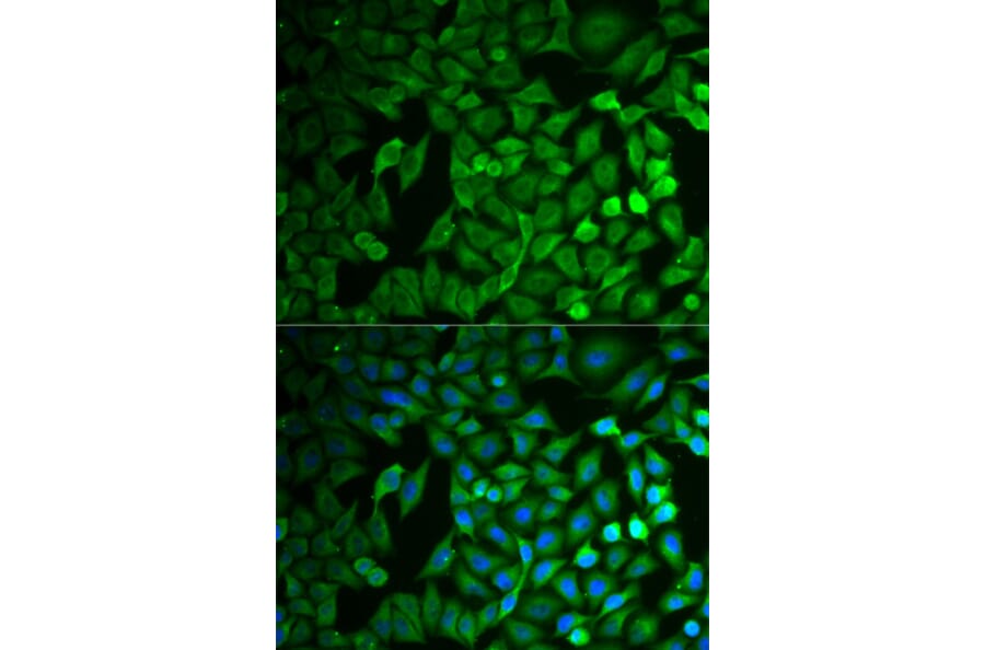 Immunofluorescence - FBXO11 antibody from Signalway Antibody (38737) - Antibodies.com