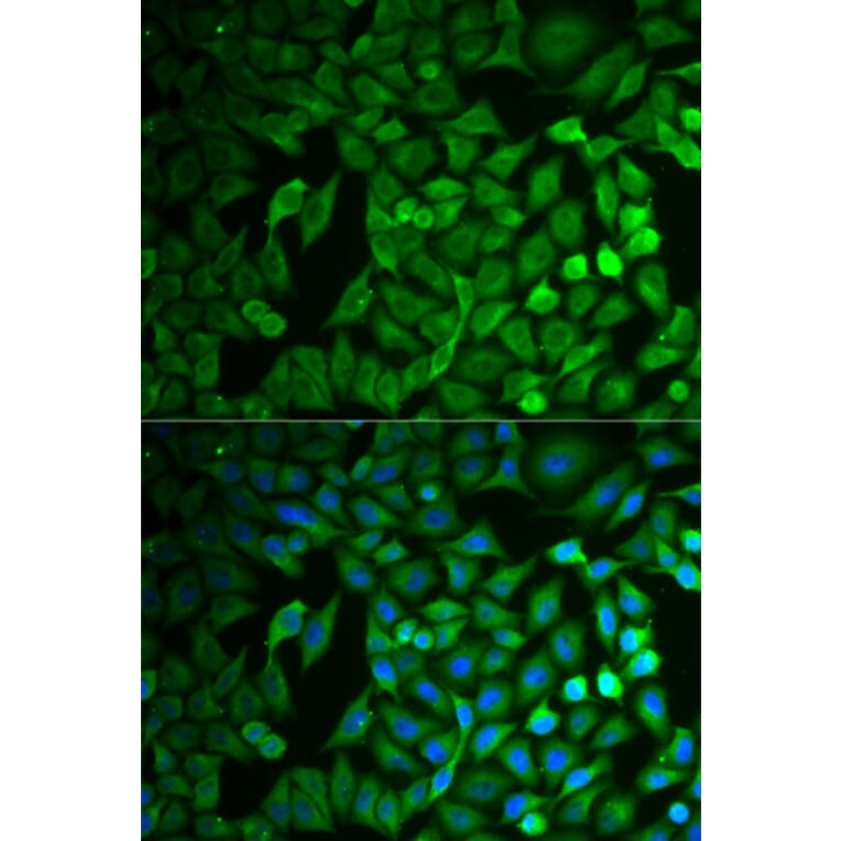 Immunofluorescence - FBXO11 antibody from Signalway Antibody (38737) - Antibodies.com