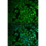 Immunofluorescence - FBXO11 antibody from Signalway Antibody (38737) - Antibodies.com