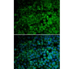 Immunofluorescence - TRIM13 antibody from Signalway Antibody (38760) - Antibodies.com