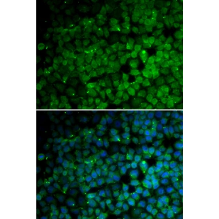 Immunofluorescence - TRIM13 antibody from Signalway Antibody (38760) - Antibodies.com