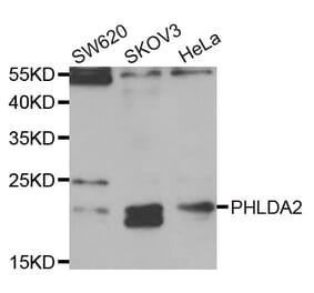 Western blot - PHLDA2 antibody from Signalway Antibody (38771) - Antibodies.com