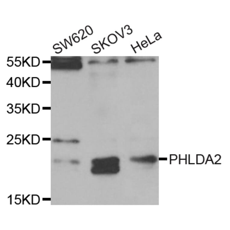 Western blot - PHLDA2 antibody from Signalway Antibody (38771) - Antibodies.com