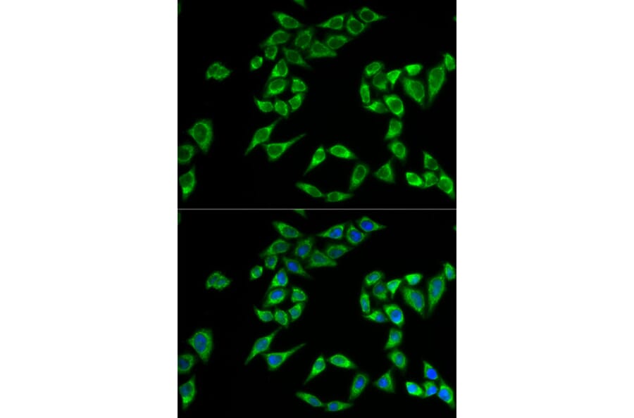 Immunofluorescence - PHLDA2 antibody from Signalway Antibody (38771) - Antibodies.com