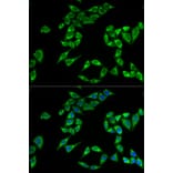 Immunofluorescence - PHLDA2 antibody from Signalway Antibody (38771) - Antibodies.com