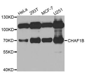 Western blot - CHAF1B antibody from Signalway Antibody (38785) - Antibodies.com