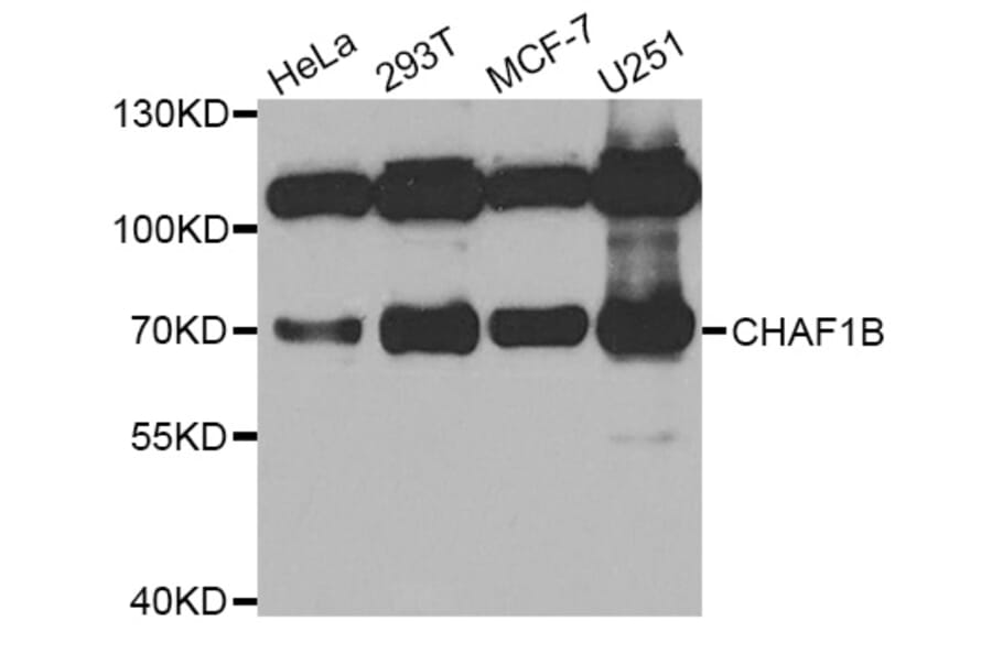 Western blot - CHAF1B antibody from Signalway Antibody (38785) - Antibodies.com