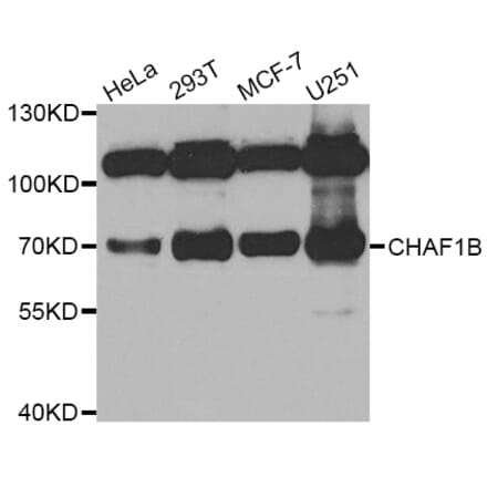 Western blot - CHAF1B antibody from Signalway Antibody (38785) - Antibodies.com