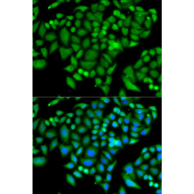 Immunofluorescence - CHAF1B antibody from Signalway Antibody (38785) - Antibodies.com