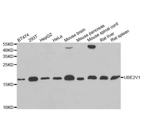 Western blot - UBE2V1 antibody from Signalway Antibody (38819) - Antibodies.com