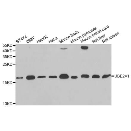 Western blot - UBE2V1 antibody from Signalway Antibody (38819) - Antibodies.com