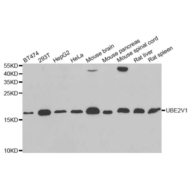 Western blot - UBE2V1 antibody from Signalway Antibody (38819) - Antibodies.com