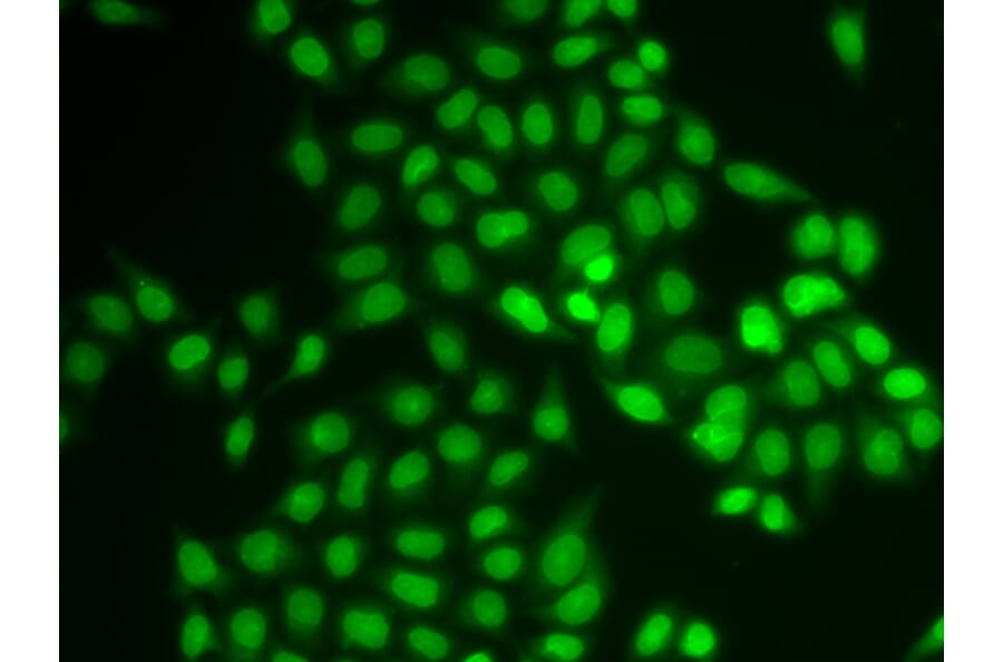 Immunofluorescence - UBE2V1 antibody from Signalway Antibody (38819) - Antibodies.com