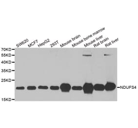 Western blot - NDUFS4 antibody from Signalway Antibody (38870) - Antibodies.com