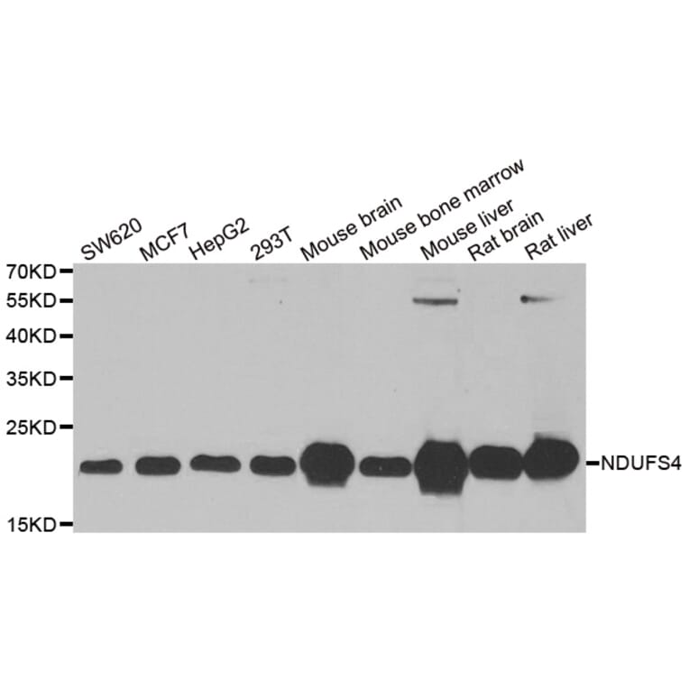 Western blot - NDUFS4 antibody from Signalway Antibody (38870) - Antibodies.com