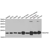 Western blot - NDUFS4 antibody from Signalway Antibody (38870) - Antibodies.com