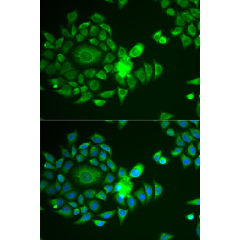 Immunofluorescence - NDUFS4 antibody from Signalway Antibody (38870) - Antibodies.com