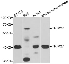 Western blot - TRIM27 antibody from Signalway Antibody (38884) - Antibodies.com