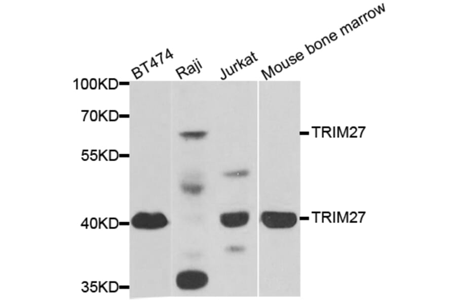 Western blot - TRIM27 antibody from Signalway Antibody (38884) - Antibodies.com