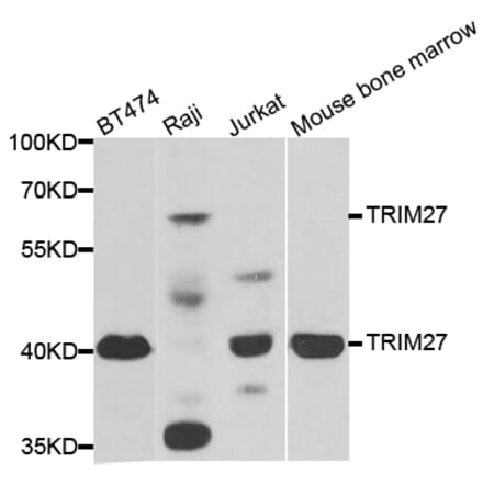Western blot - TRIM27 antibody from Signalway Antibody (38884) - Antibodies.com