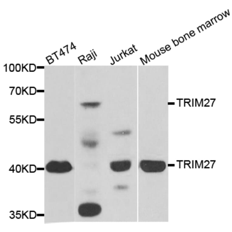 Western blot - TRIM27 antibody from Signalway Antibody (38884) - Antibodies.com