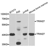 Western blot - TRIM27 antibody from Signalway Antibody (38884) - Antibodies.com