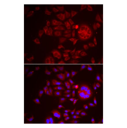 Immunofluorescence - SPINT1 antibody from Signalway Antibody (38890) - Antibodies.com