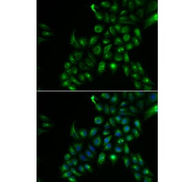 Immunofluorescence - TSPAN7 antibody from Signalway Antibody (38896) - Antibodies.com