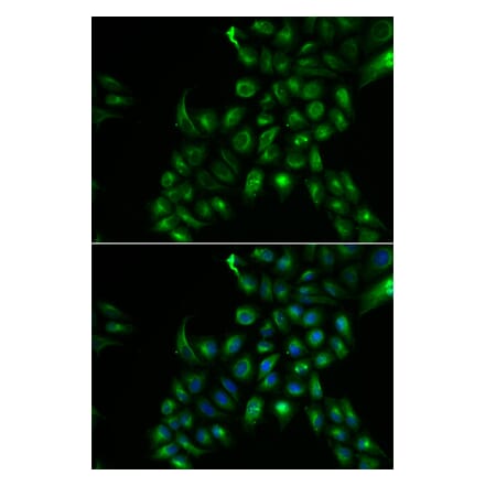 Immunofluorescence - TSPAN7 antibody from Signalway Antibody (38896) - Antibodies.com