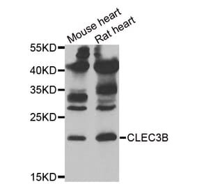 Western blot - CLEC3B antibody from Signalway Antibody (38897) - Antibodies.com