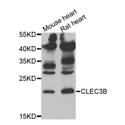 Western blot - CLEC3B antibody from Signalway Antibody (38897) - Antibodies.com