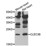 Western blot - CLEC3B antibody from Signalway Antibody (38897) - Antibodies.com