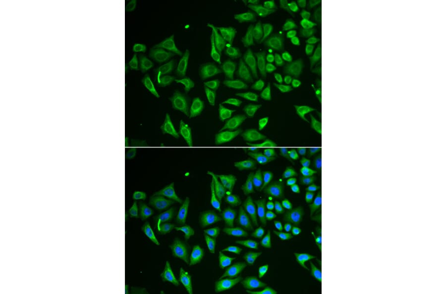 Immunofluorescence - CLEC3B antibody from Signalway Antibody (38897) - Antibodies.com